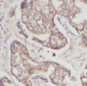 POSTN Antibody