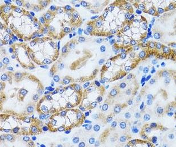 PEX5 Antibody