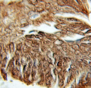 PFDN1 Antibody