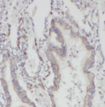 PFDN2 Antibody