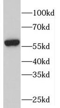 PFKFB2 Antibody