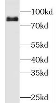 PFKL Antibody