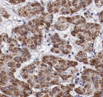 PFKL Antibody