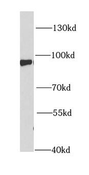 PFKM Rabbit Polyclonal Antibody