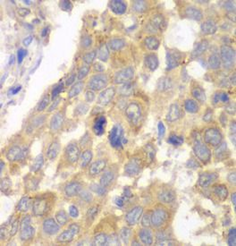 PFKM Rabbit Polyclonal Antibody