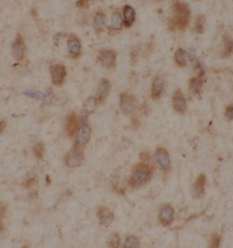 PGAM1 Antibody