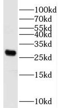PGAM2 Rabbit Polyclonal Antibody