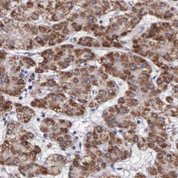PGD Rabbit Polyclonal Antibody