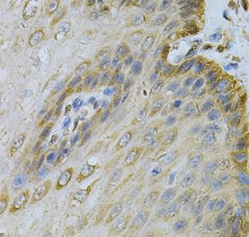 PGK1 Antibody