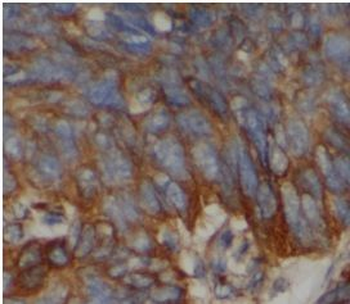 PGLYRP2 Antibody