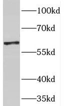 PGM1 Antibody