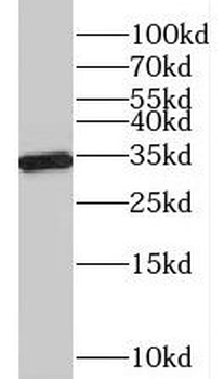 PGP Rabbit Polyclonal Antibody