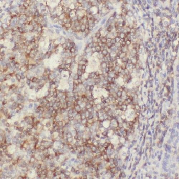 PGP Rabbit Polyclonal Antibody