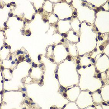 PHF11 Antibody