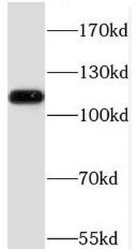 PHF12 Rabbit Polyclonal Antibody
