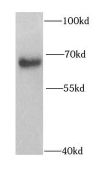 PHF19 Antibody