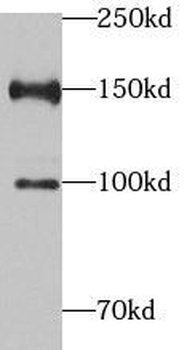 PHF2 Antibody