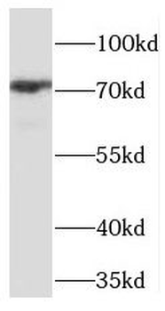 PHF21A Antibody