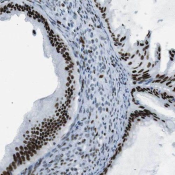 PHF6 Antibody