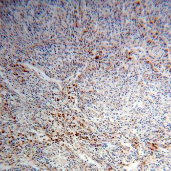 PHGDH Antibody
