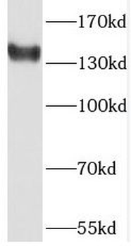 PHKA2 Rabbit Polyclonal Antibody