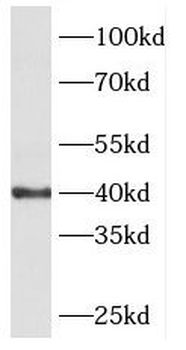 PHKG1 Antibody