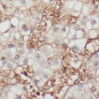 PHKG2 Antibody