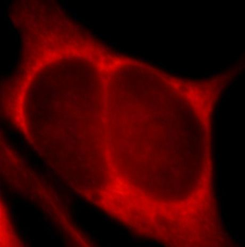 PHLPP1 Antibody