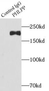 PHLPP1 Antibody
