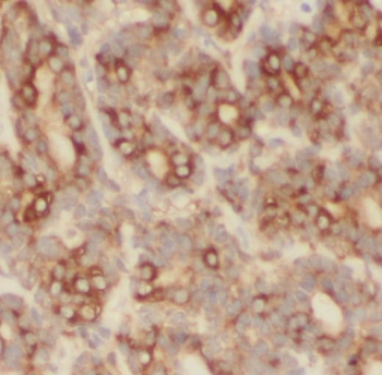 PHLPP1 Antibody