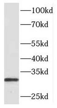 PHOX2B Antibody