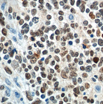 PHOX2B Antibody