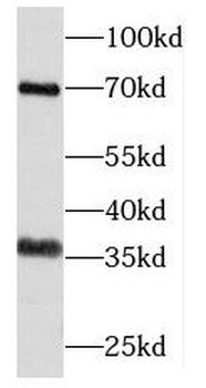 PHYH Antibody