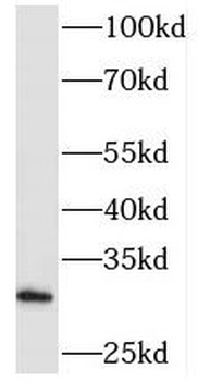 PHYHD1 Rabbit Polyclonal Antibody