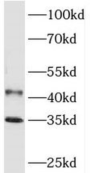 PHYHIP Antibody