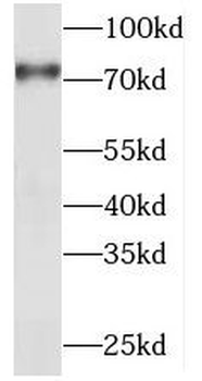 PIAS1 Antibody
