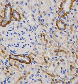 PIBF1 Antibody