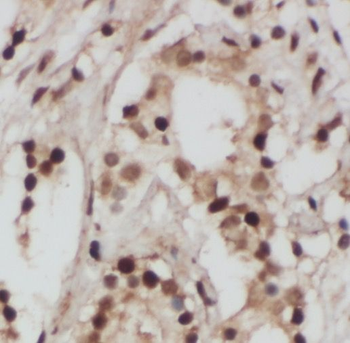 PICK1 Antibody