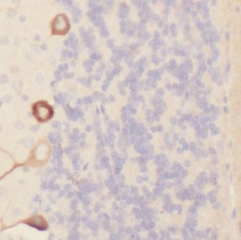 PIEZO1 Antibody