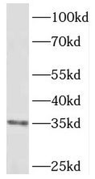 TP53I3 Antibody