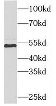 PIGB Rabbit Polyclonal Antibody