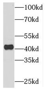 PIGK Rabbit Polyclonal Antibody