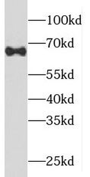 PIGT Antibody