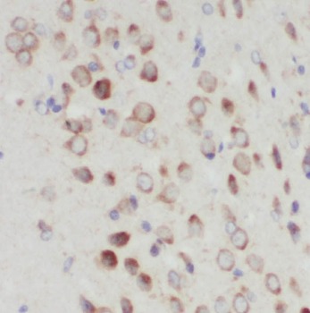 PIGT Antibody