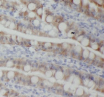 PIGZ Antibody