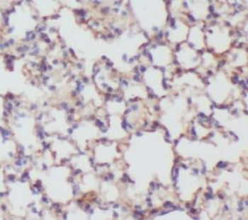 PIH1D1 Antibody
