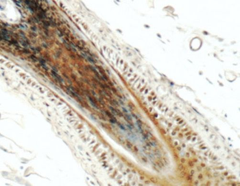 PINX1 Antibody
