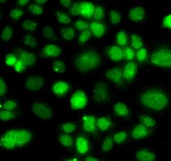 PIP4K2A Antibody