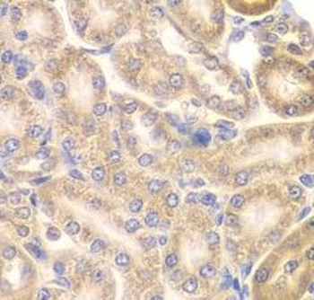 PIP4K2A Antibody