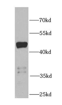 PIP4K2B Antibody